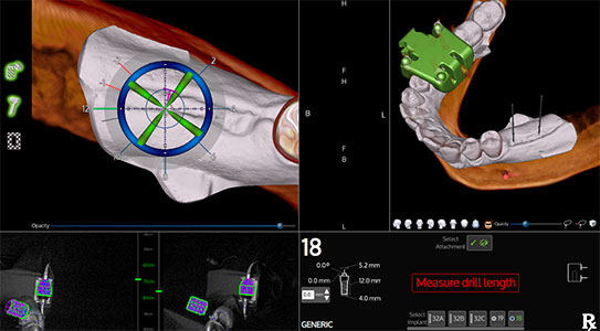Surgical Navigation imagery