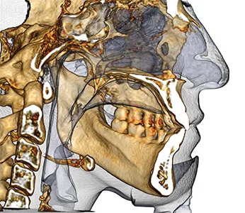 3D imaging example image