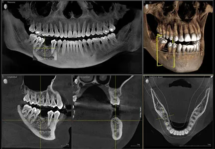 3D imaging example image